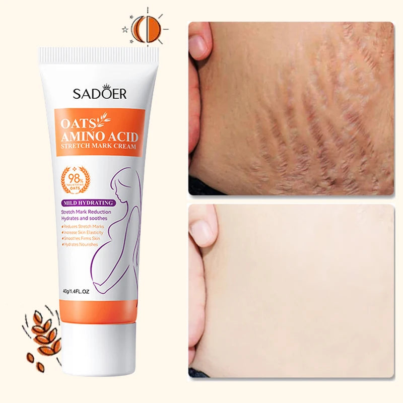 Anti Stretch Marks Body Cream Removal 40g