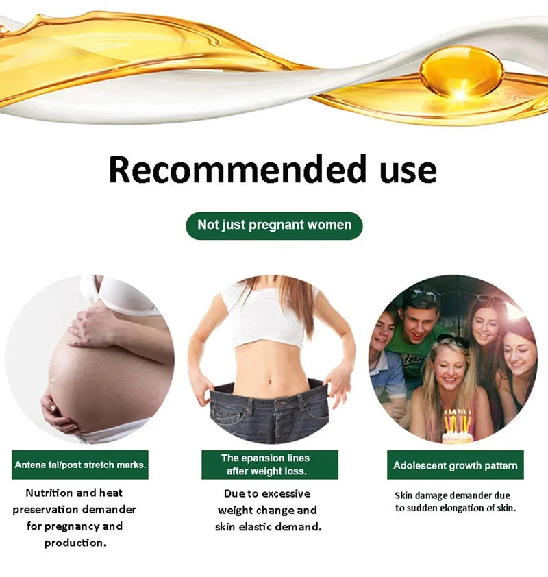 Anti Stretch Marks Body Cream Removal 40g