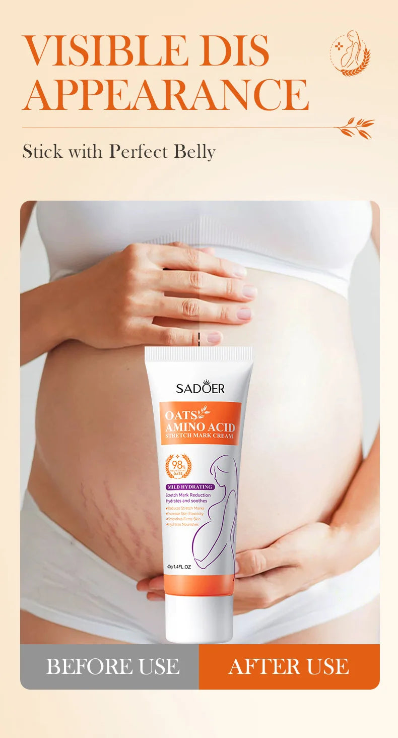 Anti Stretch Marks Body Cream Removal 40g
