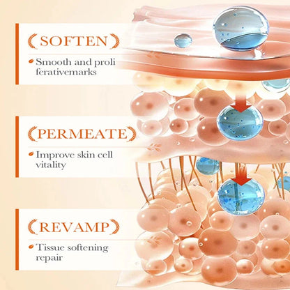 Anti Stretch Marks Body Cream Removal 40g