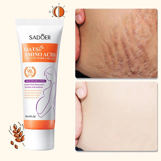 Anti Stretch Marks Body Cream Removal 40g