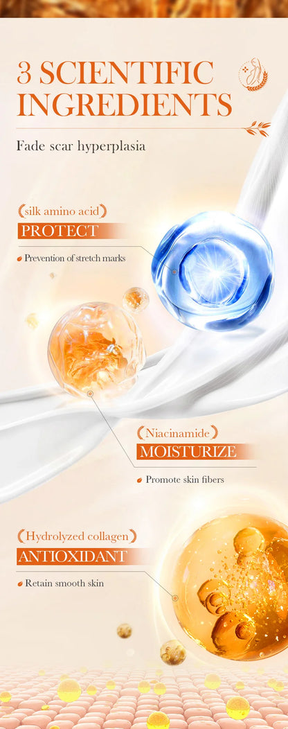 Anti Stretch Marks Body Cream Removal 40g